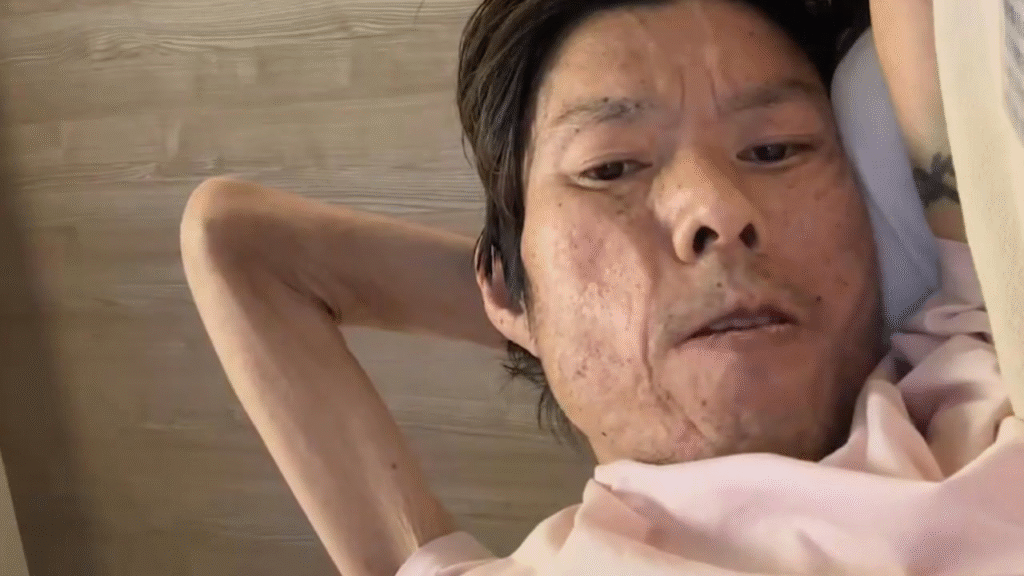 金バエ 死亡